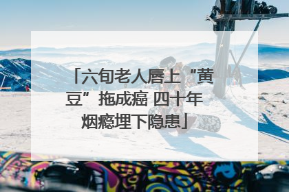 六旬老人唇上“黄豆”拖成癌 四十年烟瘾埋下隐患